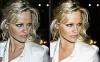Before and After: Pamela Anderson